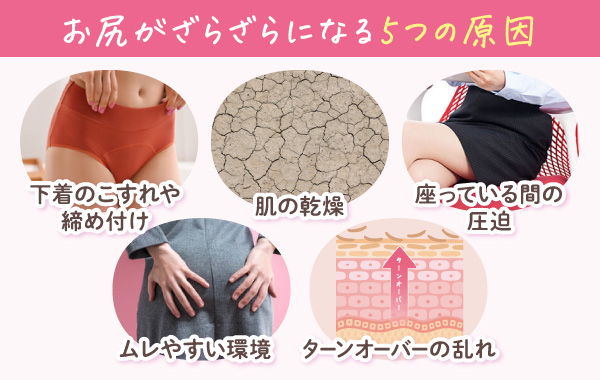 お尻がざらざらになる5つの原因を示す図（下着のこすれ・肌の乾燥・圧迫・ムレ・ターンオーバーの乱れ）