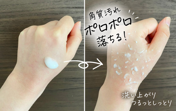 手の甲にILUSミルクピーリングを施している様子